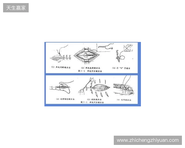 广州豹官方：杨浩眉弓伤口缝合30余针，预计5-7天后拆线